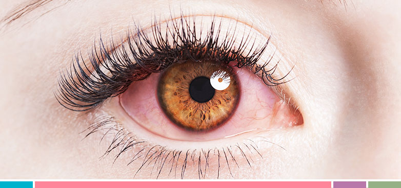 Cómo maquillarse cuando tienes alergia ocular?