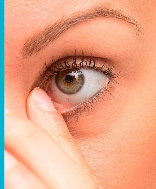 ¿Qué causa una infección en los ojos?