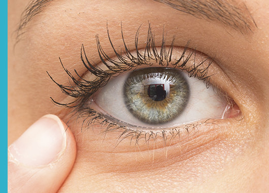 Patologías asociadas a los ojos y al contorno de ojos